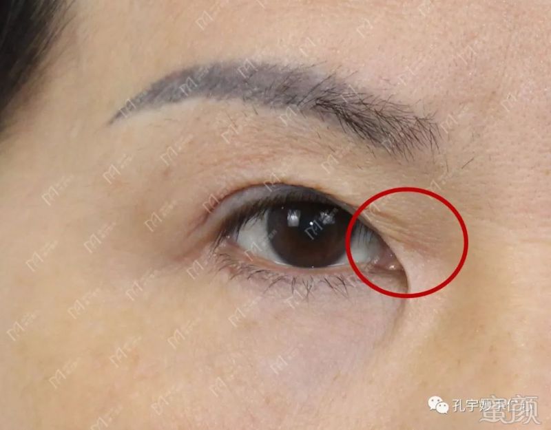 https://img.miyanlife.com/mnt/timg/181119/113Q12458-4.jpg