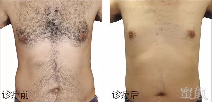 https://img.miyanlife.com/mnt/timg/181119/1145393554-10.jpg