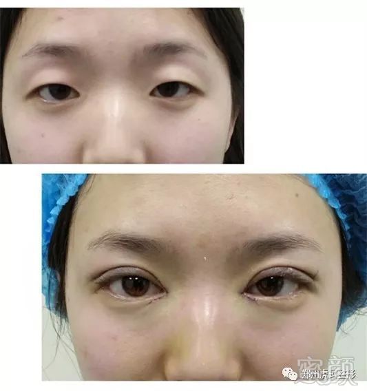https://img.miyanlife.com/mnt/timg/181119/12025I3U-1.jpg