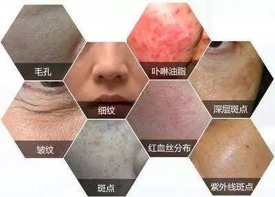 https://img.miyanlife.com/mnt/timg/181119/121J31935-0.jpg