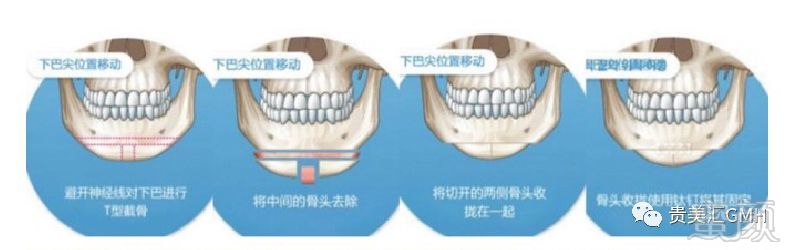 案例图片