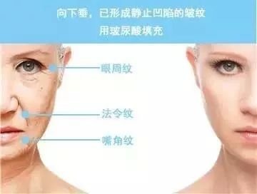 https://img.miyanlife.com/mnt/timg/181120/11535M553-7.jpg