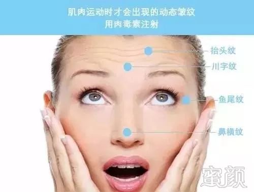 https://img.miyanlife.com/mnt/timg/181120/11535M612-8.jpg