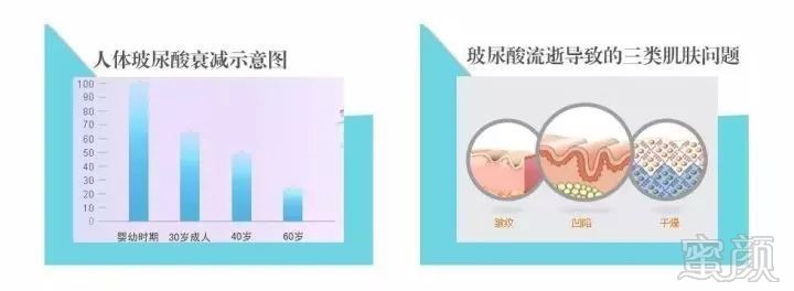 https://img.miyanlife.com/mnt/timg/181120/1204114P3-3.jpg