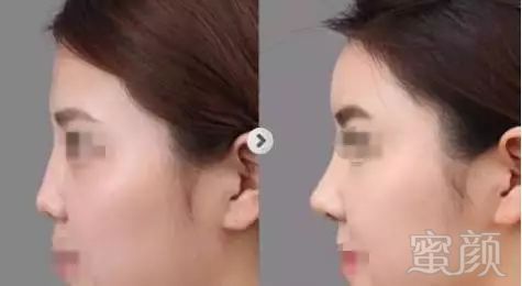 https://img.miyanlife.com/mnt/timg/181120/120411AV-6.jpg