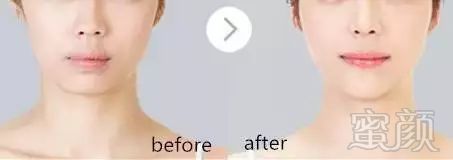 https://img.miyanlife.com/mnt/timg/181120/1204123311-7.jpg