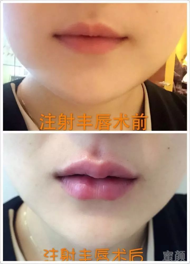https://img.miyanlife.com/mnt/timg/181120/1204124638-9.jpg