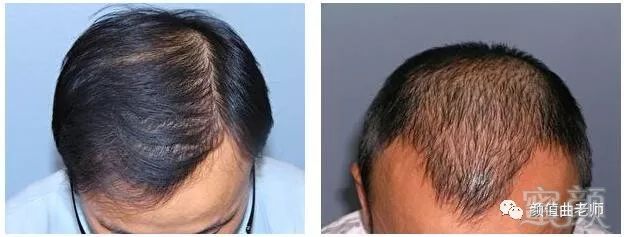https://img.miyanlife.com/mnt/timg/181120/121TaX4-3.jpg