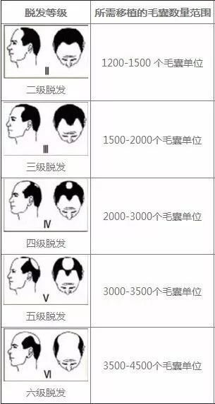 https://img.miyanlife.com/mnt/timg/181120/1222442940-0.jpg