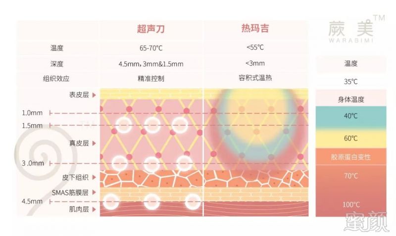 https://img.miyanlife.com/mnt/timg/181120/124Q621V-1.jpg