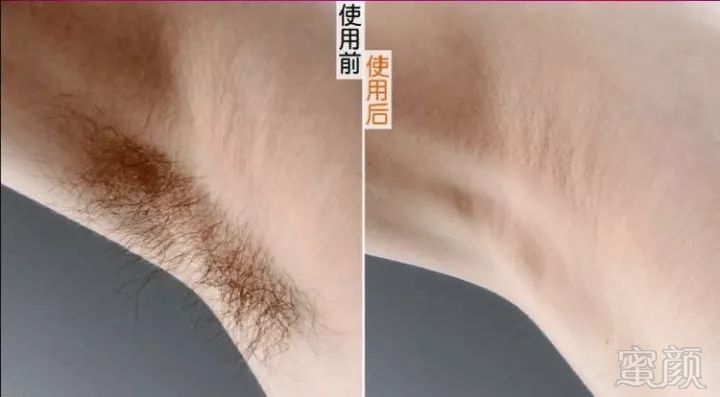 https://img.miyanlife.com/mnt/timg/181121/11101010Z-2.jpg
