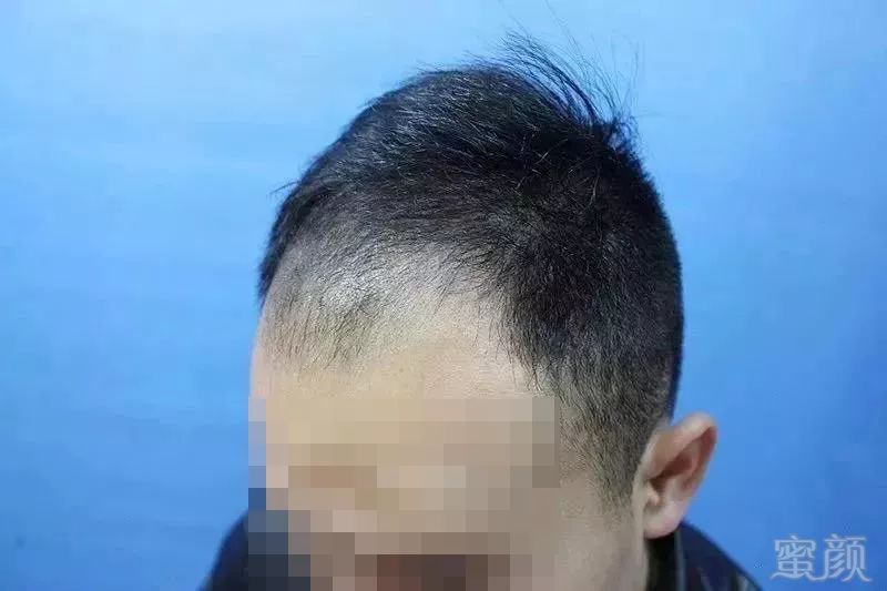 https://img.miyanlife.com/mnt/timg/181121/121Q96047-2.jpg