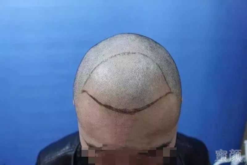 https://img.miyanlife.com/mnt/timg/181121/121Q9D52-4.jpg
