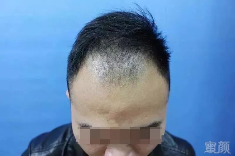 https://img.miyanlife.com/mnt/timg/181121/121QR151-0.jpg
