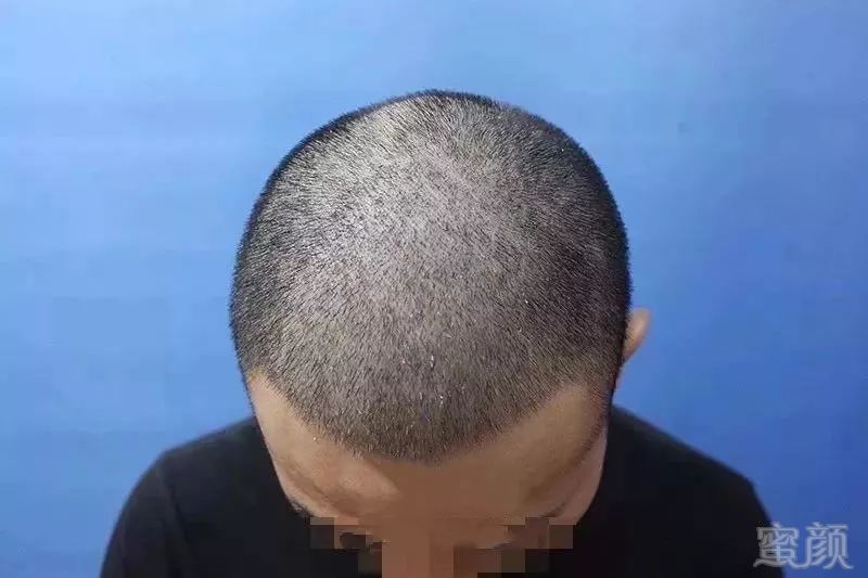 https://img.miyanlife.com/mnt/timg/181121/121Qa2W-5.jpg