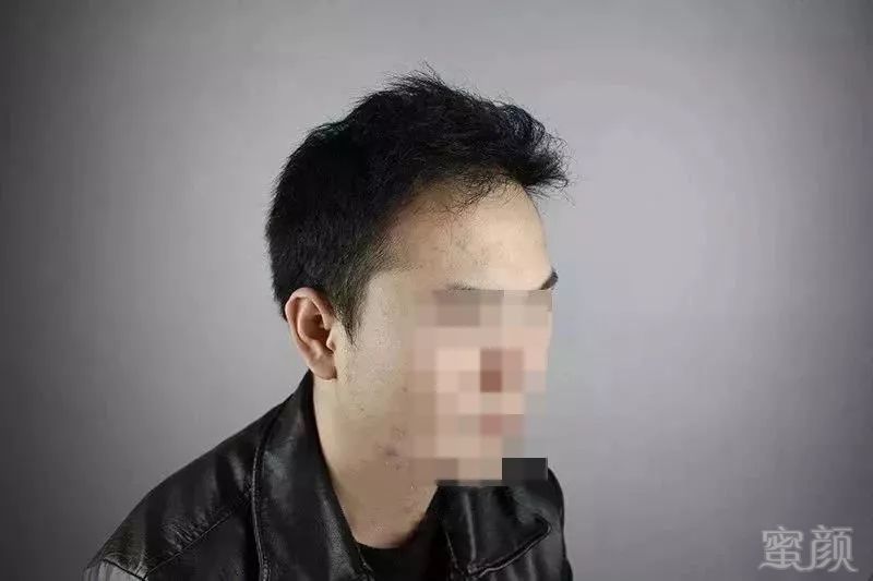 https://img.miyanlife.com/mnt/timg/181121/121R04022-8.jpg