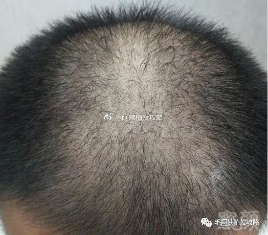 https://img.miyanlife.com/mnt/timg/181121/1221442163-0.jpg