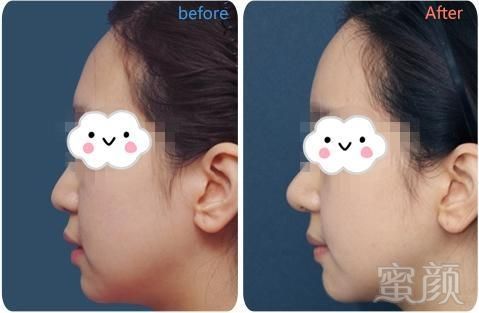 https://img.miyanlife.com/mnt/timg/181121/1K6436123-9.jpg
