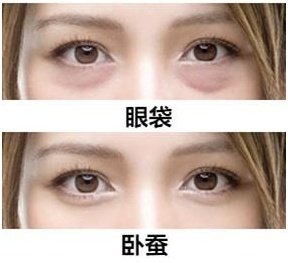 https://img.miyanlife.com/mnt/timg/181121/1S2203931-1.jpg