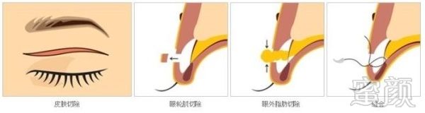 https://img.miyanlife.com/mnt/timg/181121/1U30G334-4.jpg