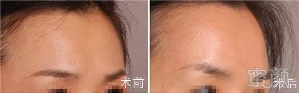 https://img.miyanlife.com/mnt/timg/181122/104232CM-6.jpg