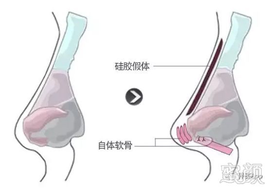 案例图片