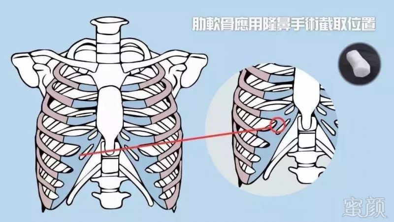 案例图片