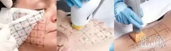 https://img.miyanlife.com/mnt/timg/181122/1230412T0-3.jpg