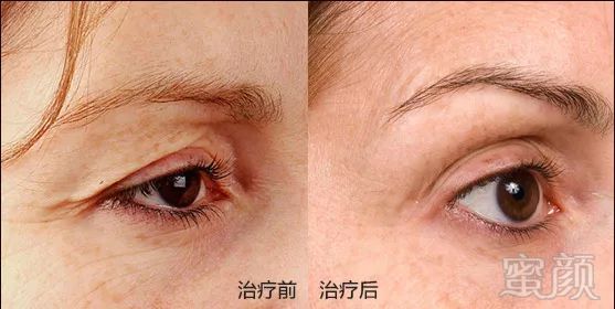 https://img.miyanlife.com/mnt/timg/181122/123042N28-7.jpg