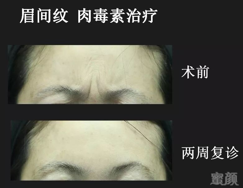 https://img.miyanlife.com/mnt/timg/181123/113KWR3-4.jpg