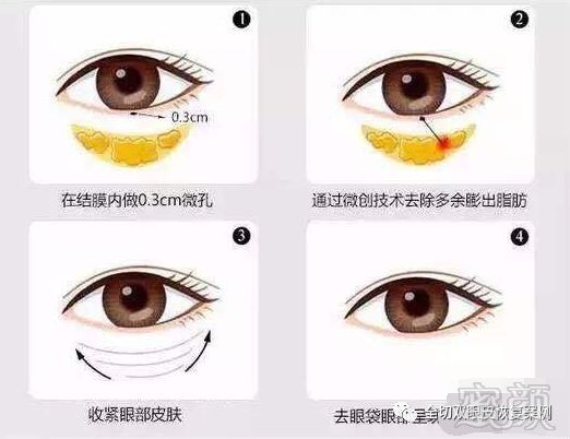 https://img.miyanlife.com/mnt/timg/181123/12042Q614-2.jpg
