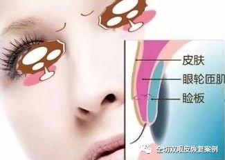 https://img.miyanlife.com/mnt/timg/181123/12042W4Q-1.jpg