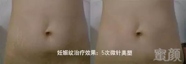 https://img.miyanlife.com/mnt/timg/181123/121P61053-8.jpg