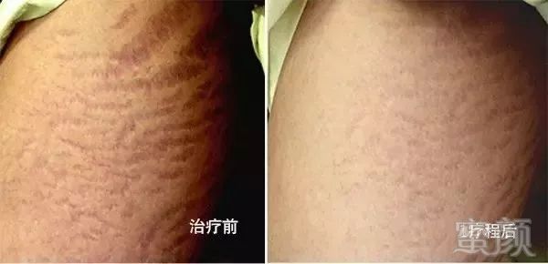 https://img.miyanlife.com/mnt/timg/181123/121P610G-9.jpg