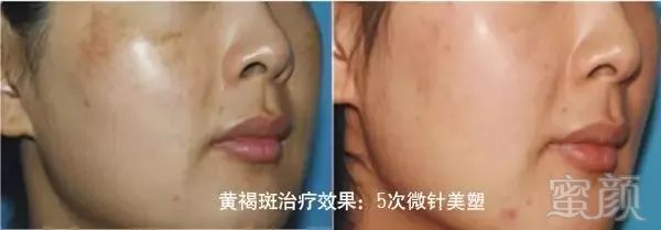 https://img.miyanlife.com/mnt/timg/181123/121P62346-7.jpg