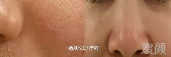 https://img.miyanlife.com/mnt/timg/181123/121P63916-10.jpg