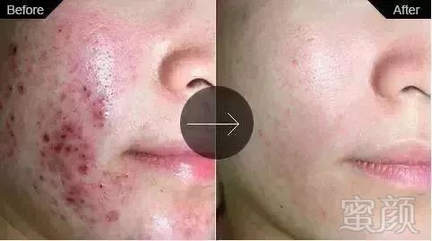 https://img.miyanlife.com/mnt/timg/181123/121PA563-6.jpg