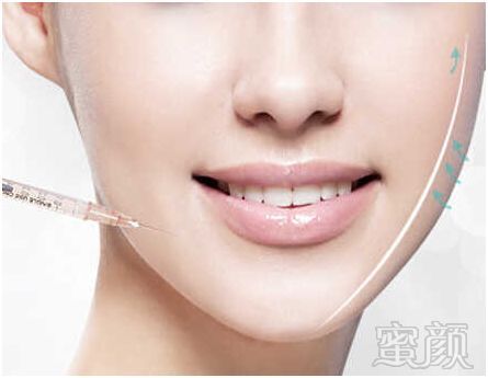 https://img.miyanlife.com/mnt/timg/181123/121ZU924-3.jpg