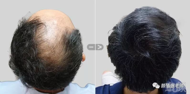 https://img.miyanlife.com/mnt/timg/181123/122345A56-3.jpg
