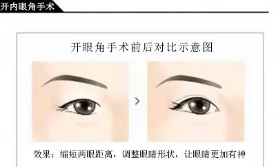 https://img.miyanlife.com/mnt/timg/181123/12331RV9-2.jpg