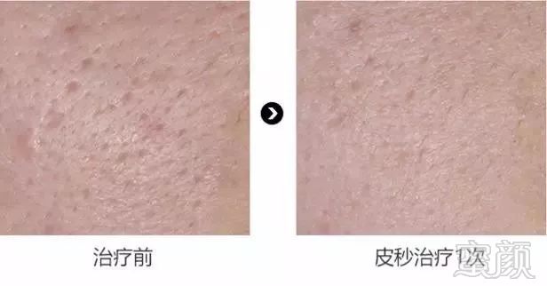 https://img.miyanlife.com/mnt/timg/181124/1125514019-8.jpg