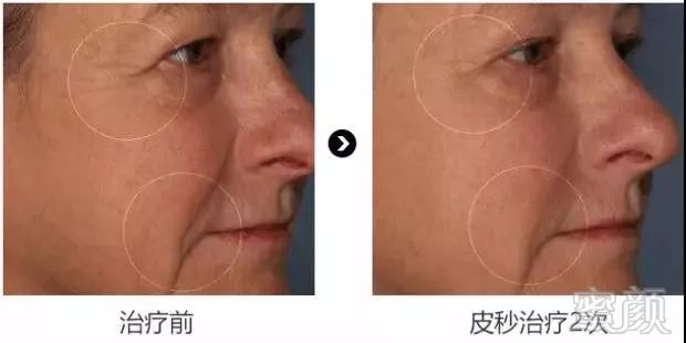 https://img.miyanlife.com/mnt/timg/181124/112551O28-6.jpg
