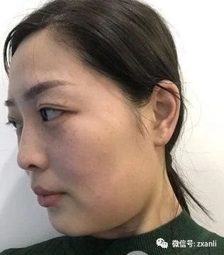 https://img.miyanlife.com/mnt/timg/181124/112K3K96-0.jpg