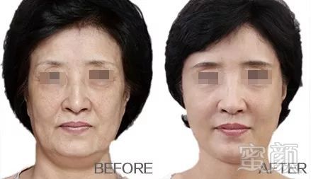 https://img.miyanlife.com/mnt/timg/181124/1130332Z9-6.jpg