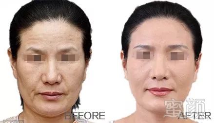https://img.miyanlife.com/mnt/timg/181124/113033I38-8.jpg