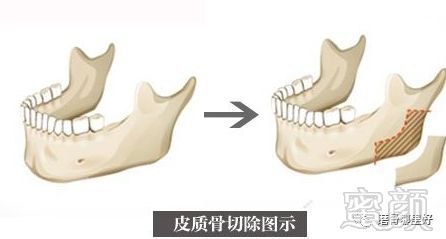 案例图片