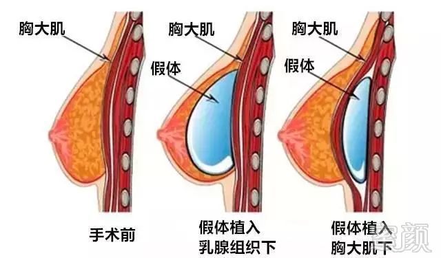 案例图片