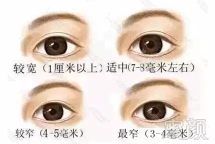 https://img.miyanlife.com/mnt/timg/181124/1232203509-7.jpg