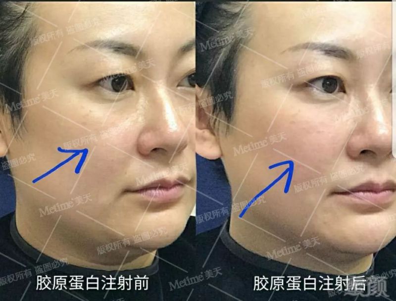https://img.miyanlife.com/mnt/timg/181124/123553AZ-3.jpg