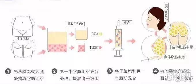 案例图片